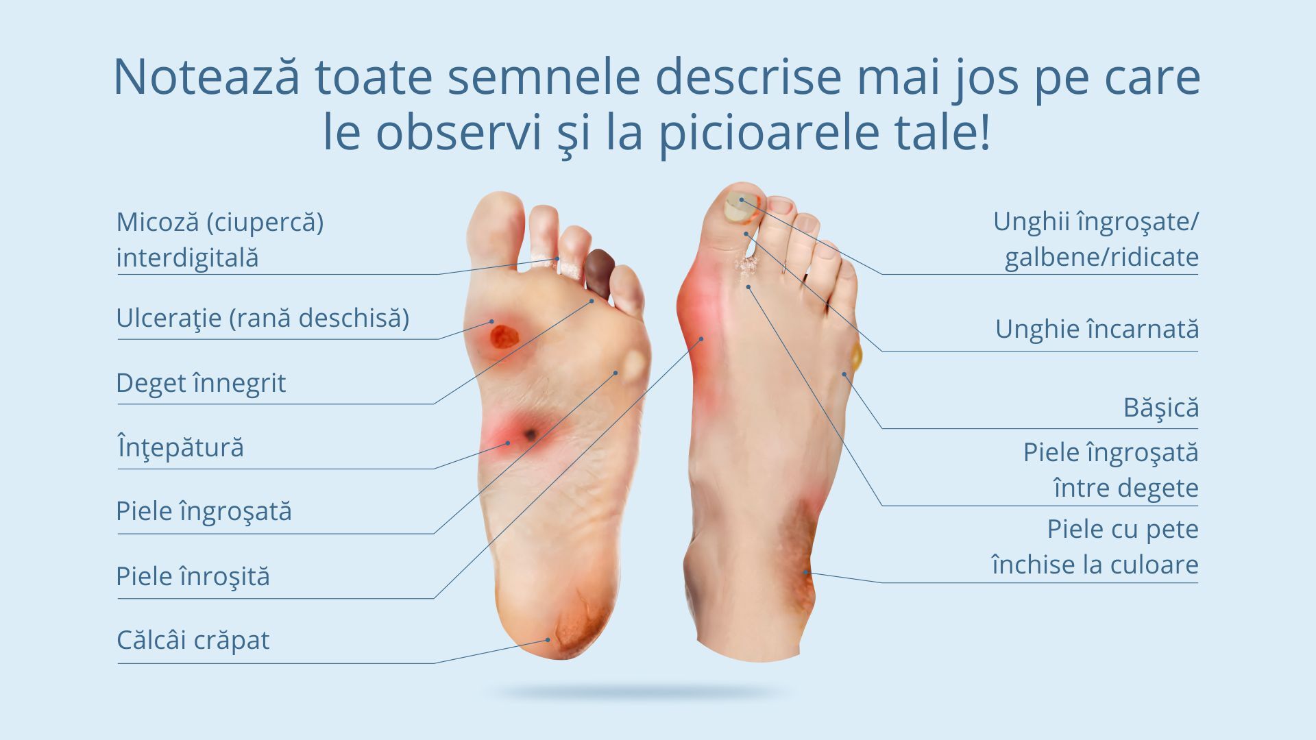 Semne micoza unghiilor - ghid vizual